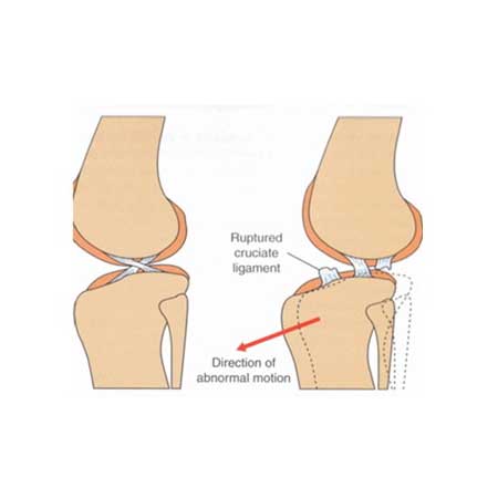 orthop_02_2