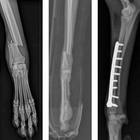 orthop_04